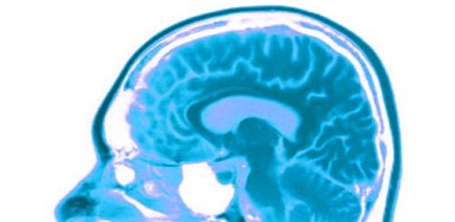 brain-in-blue A blue brain - Be narrow-minded for profit and happiness